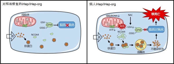 线粒体疾病肝细胞的全新铁死亡模式、细胞器互作机制